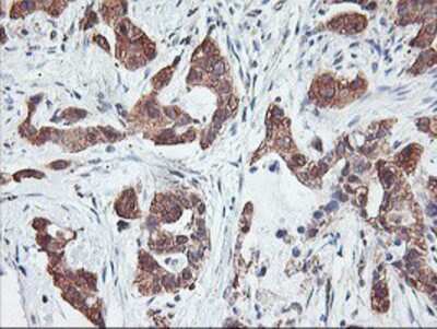 Immunohistochemistry-Paraffin: PFDN6 Antibody (OTI4E10) [NBP2-01637]