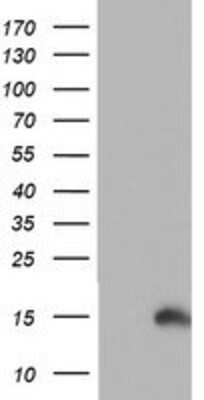 Western Blot: PFDN6 Antibody (OTI4E10) [NBP2-01637]