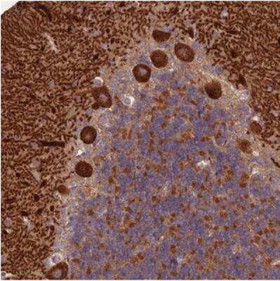 Immunohistochemistry: PFDN6 Antibody [NBP2-30389]