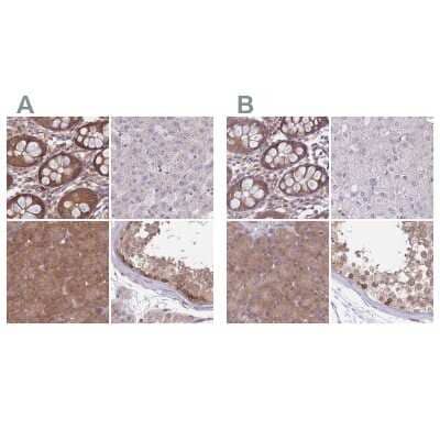 Immunohistochemistry-Paraffin: PFDN6 Antibody [NBP2-30389]