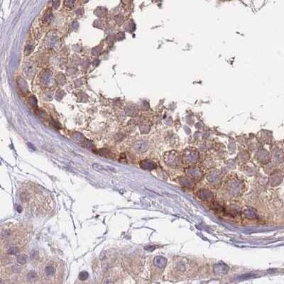 Immunohistochemistry-Paraffin: PFDN6 Antibody [NBP2-30389]