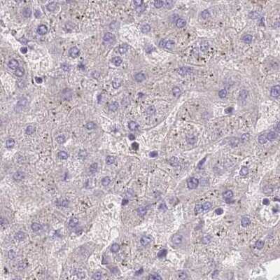 Immunohistochemistry-Paraffin: PFDN6 Antibody [NBP2-30389]
