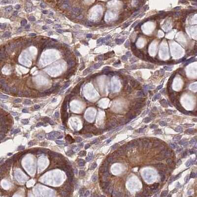 Immunohistochemistry-Paraffin: PFDN6 Antibody [NBP2-30389]