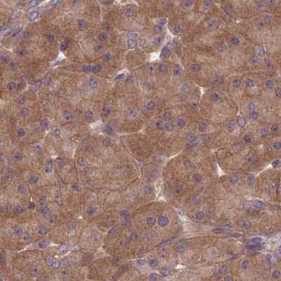 Immunohistochemistry-Paraffin: PFDN6 Antibody [NBP2-30389]