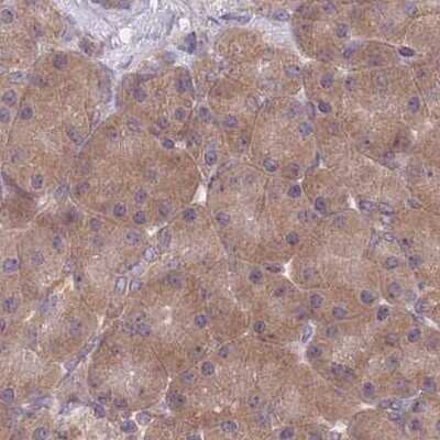 Immunohistochemistry-Paraffin: PFDN6 Antibody [NBP2-47335]