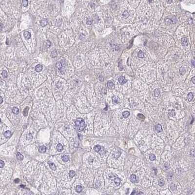 Immunohistochemistry-Paraffin: PFDN6 Antibody [NBP2-47335]