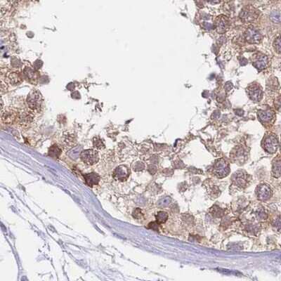 Immunohistochemistry-Paraffin: PFDN6 Antibody [NBP2-47335]