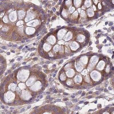 Immunohistochemistry-Paraffin: PFDN6 Antibody [NBP2-47335]