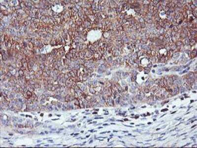 Immunohistochemistry: PFDN6 Antibody (OTI4E10) - Azide and BSA Free [NBP2-73339]