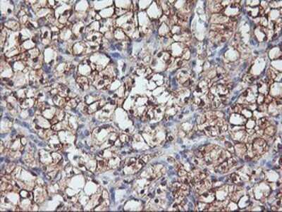 Immunohistochemistry: PFDN6 Antibody (OTI4E10) - Azide and BSA Free [NBP2-73339]