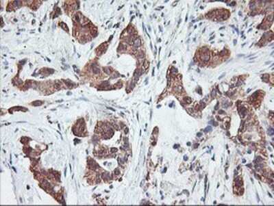 Immunohistochemistry: PFDN6 Antibody (OTI4E10) - Azide and BSA Free [NBP2-73339]
