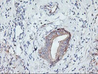 Immunohistochemistry: PFDN6 Antibody (OTI4E10) - Azide and BSA Free [NBP2-73339]