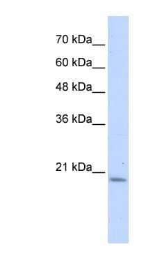 Western Blot: PFDN6 Antibody [NBP1-56417]