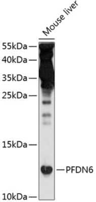 Western Blot: PFDN6 AntibodyBSA Free [NBP2-94144]