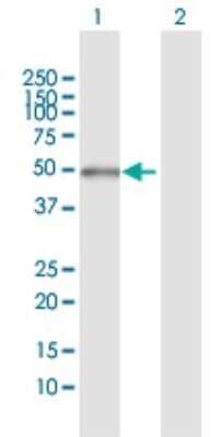 Western Blot: PFKFB1 Antibody [H00005207-D01P]