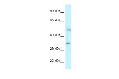 Western Blot: PFKFB1 Antibody [NBP2-84216]