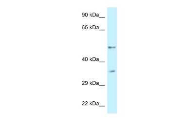 Western Blot: PFKFB1 Antibody [NBP2-84217]