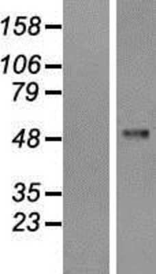 Western Blot: PFKFB1 Overexpression Lysate [NBP2-08088]