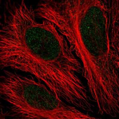 Immunocytochemistry/ Immunofluorescence: PFKFB2 Antibody [NBP2-33584]