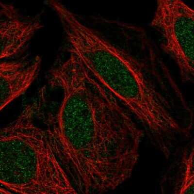 Immunocytochemistry/ Immunofluorescence: PFKFB2 Antibody [NBP2-57257]