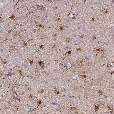 Immunohistochemistry: PFKFB2 Antibody [NBP2-33584]