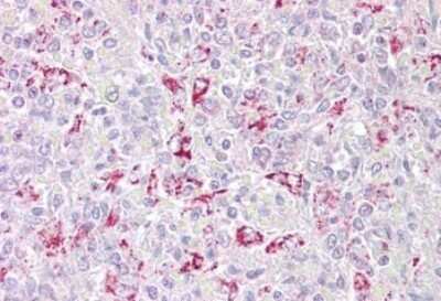 Immunohistochemistry-Paraffin: PFKFB2 Antibody [NBP1-45238]