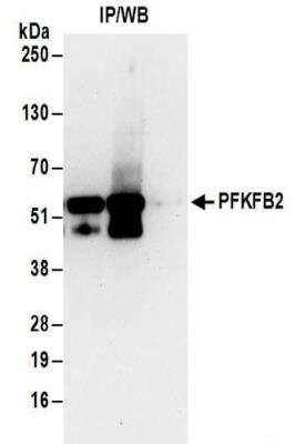 Immunoprecipitation: PFKFB2 Antibody [NBP2-32194]