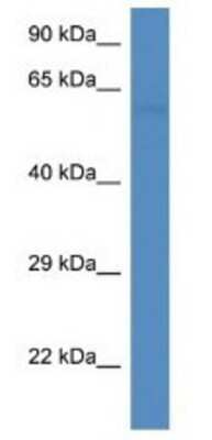 Western Blot: PFKFB2 Antibody [NBP1-79635]