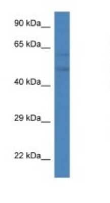 Western Blot: PFKFB2 Antibody [NBP1-79636]