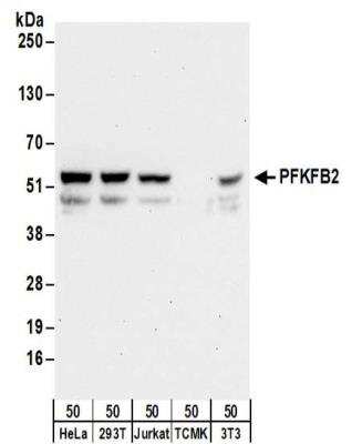 Western Blot: PFKFB2 Antibody [NBP2-32194]