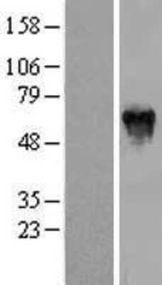 Western Blot: PFKFB2 Overexpression Lysate [NBL1-14311]