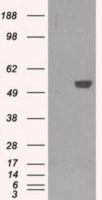 Western Blot: PFKFB4 Antibody (OTI1C8) [NBP2-02226]