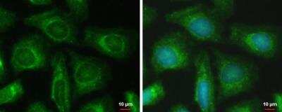 Immunocytochemistry/ Immunofluorescence: PFKFB4 Antibody [NBP1-32538]