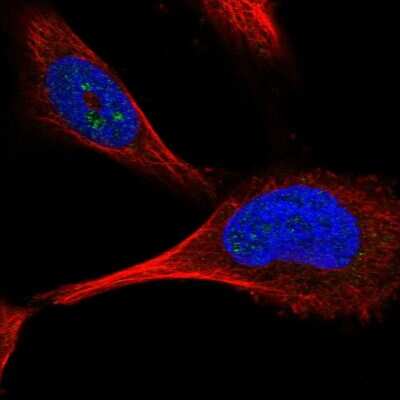 Immunocytochemistry/ Immunofluorescence: PFKFB4 Antibody [NBP2-55750]