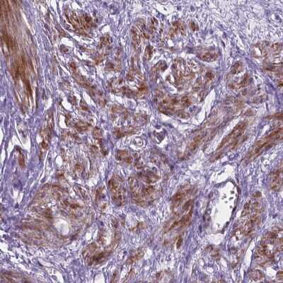 Immunohistochemistry: PFKFB4 Antibody [NBP2-49471]