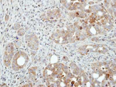 Immunohistochemistry-Paraffin: PFKFB4 Antibody [NBP1-32538]