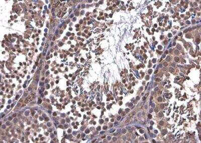 Immunohistochemistry-Paraffin: PFKFB4 Antibody [NBP1-32538]