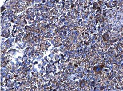 Immunohistochemistry-Paraffin: PFKFB4 Antibody [NBP1-32538]