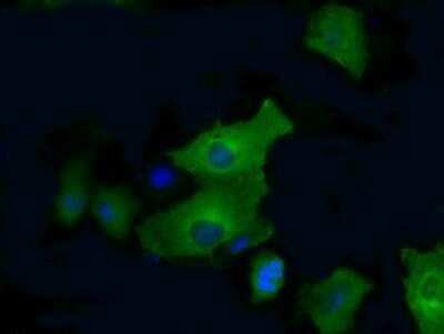 Immunocytochemistry/ Immunofluorescence: PFKFB4 Antibody (OTI1C8) - Azide and BSA Free [NBP2-73340]
