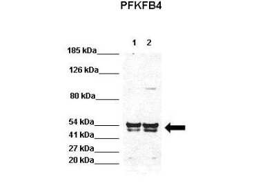 Western Blot: PFKFB4 Antibody [NBP1-57620]