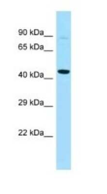 Western Blot: PFKFB4 Antibody [NBP1-98575]