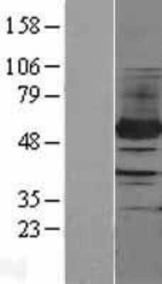 Western Blot: PFKFB4 Overexpression Lysate [NBL1-14313]