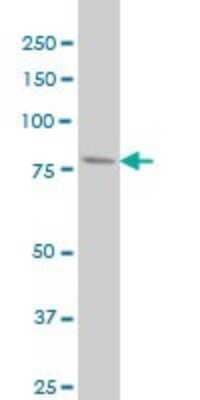 Western Blot: PFKL Antibody (2A9) [H00005211-M03]