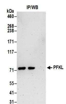 Immunoprecipitation: PFKL Antibody [NBP2-32212]