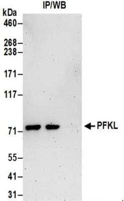 Immunoprecipitation: PFKL Antibody [NBP2-32213]