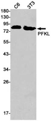 Western Blot: PFKL Antibody (S04-7A4) [NBP3-19738]