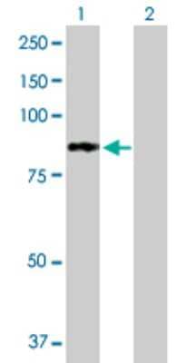 Western Blot: PFKL Antibody [H00005211-B01P]