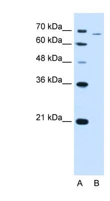 Western Blot: PFKL Antibody [NBP1-56607]
