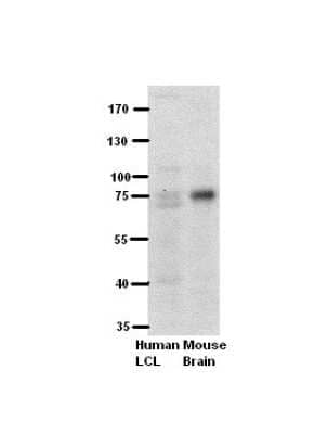 Western Blot: PFKL Antibody [NBP1-56607]