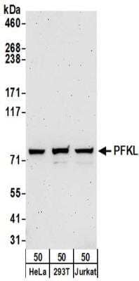 Western Blot: PFKL Antibody [NBP2-32212]